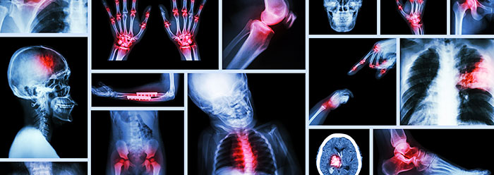 Orthopedic Surgery and Rehabilitation